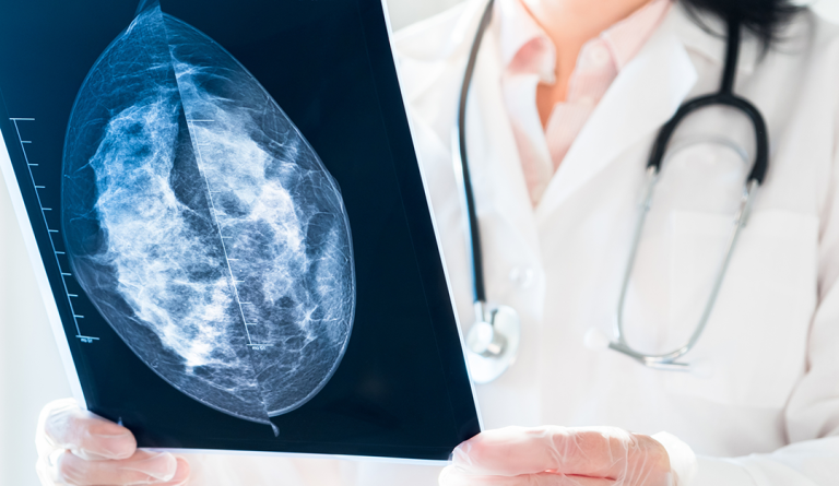 a female doctor looks at an x-ray of a breast from a mammogram