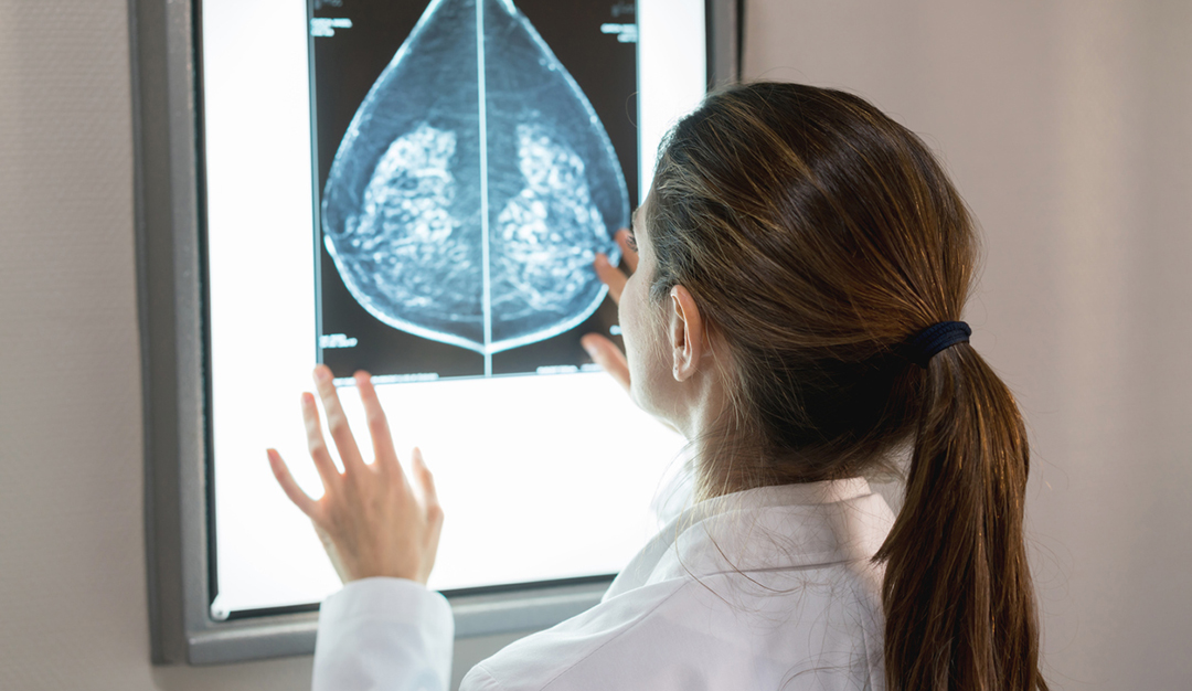Breast Anatomy: Understanding the Structure, Function, and Role in Breast Health