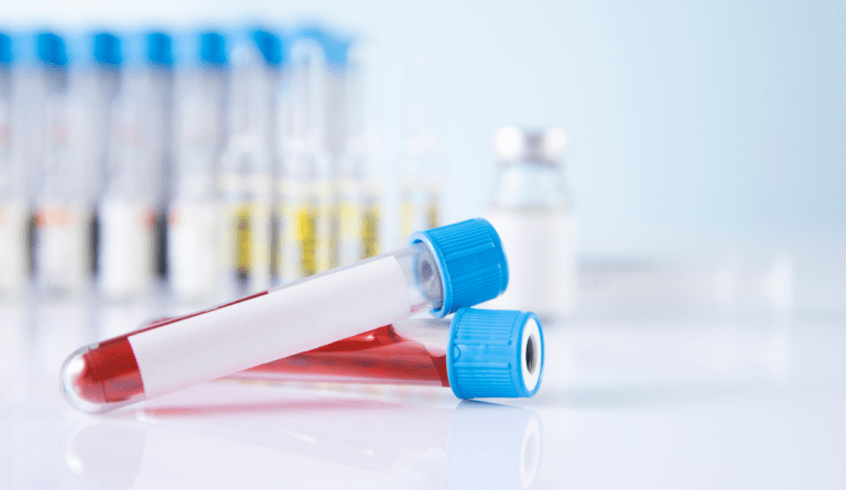 a photo of two vials used to take blood draws