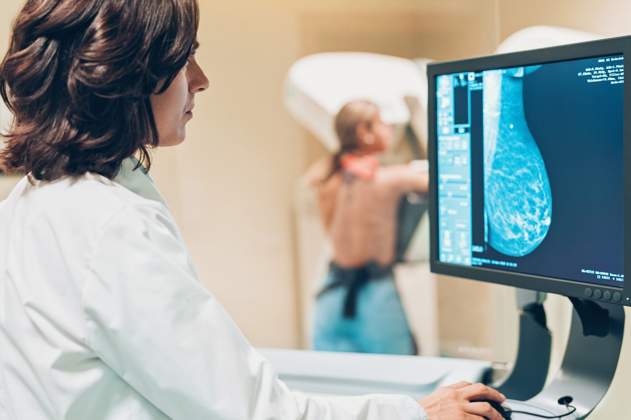 Dense Breast Tissue: What It Means and What to Know