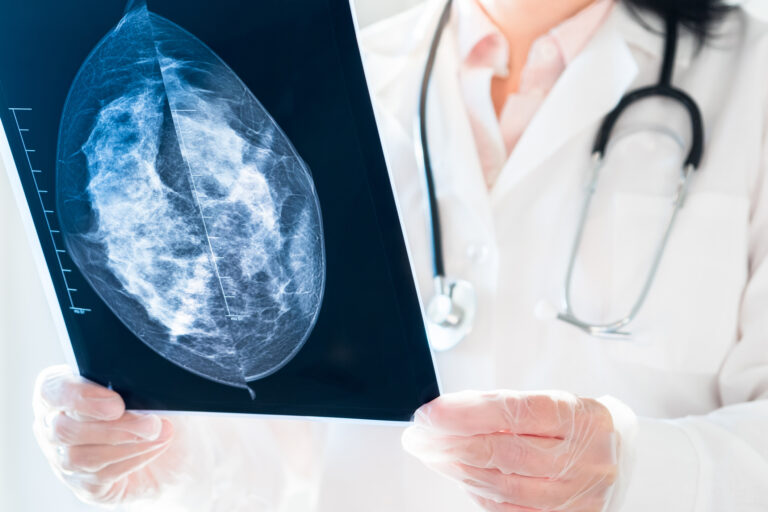 Female doctor looking at mammography results on x-ray.